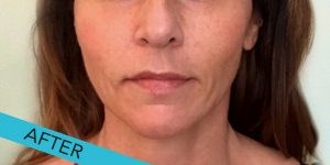 JB Cosmetic: Top skin clinic Cardiff